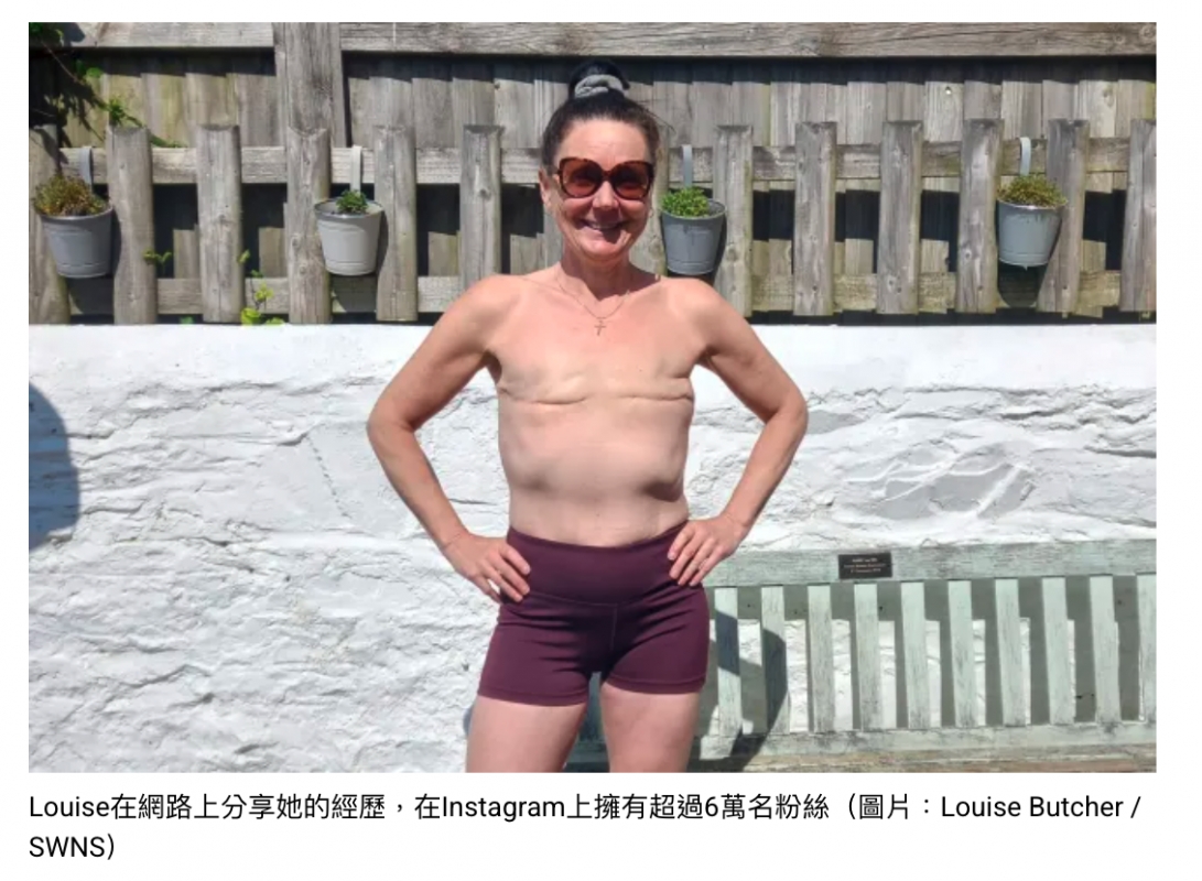 了1 ! Louise在網路上分享她的經歷,在Instagram上擁有超過6萬名粉絲(BH Louise Butcher
