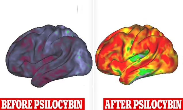 2024-07-21
神經科學家 尼科 · 多森巴赫博士報告說，當藥物 psilocybin 生效 ...